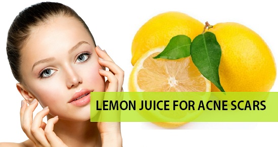 Wellhealthorganic.com : remove dark spots on face tang – lemon juice